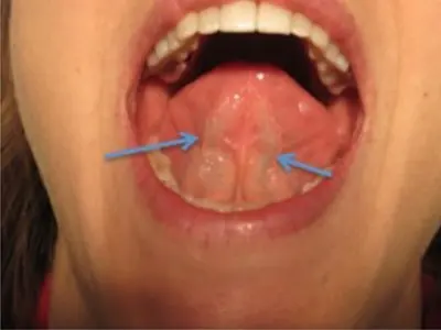 Orientación protocolo oral sublingual